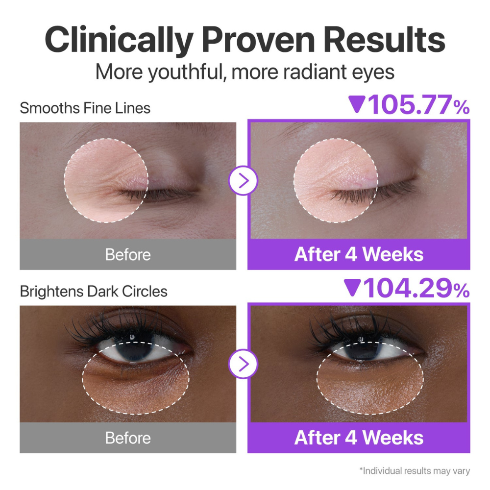 Retinol Eye Contour Serum