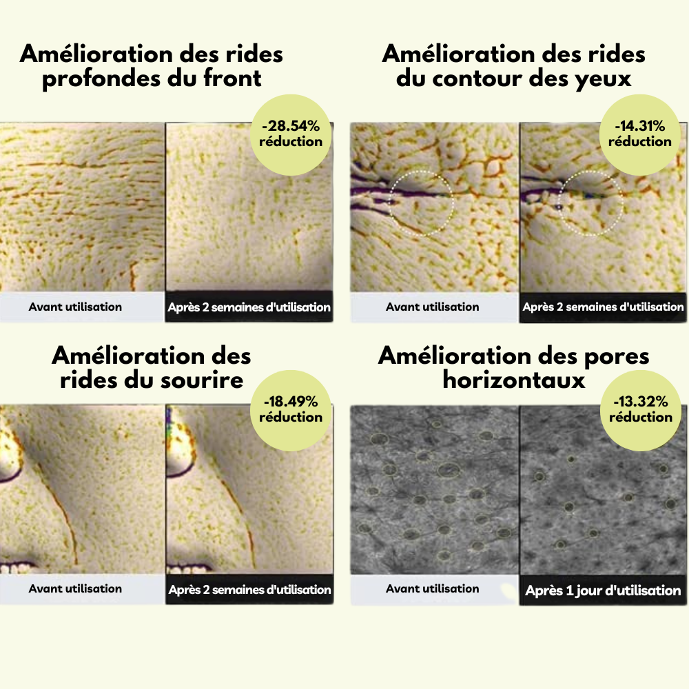Sérum Anti-Rides Tenseur au Rétinal